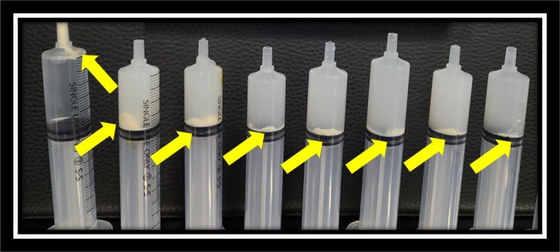 노란색 화살표로 포시된 것이 석회를 분쇄해서 흡입한 석회들입니다.