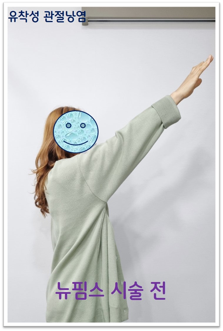 가동범위로 상부로 들어올리는 것이 약 100도 정도 제한이 있는 모습입니다.